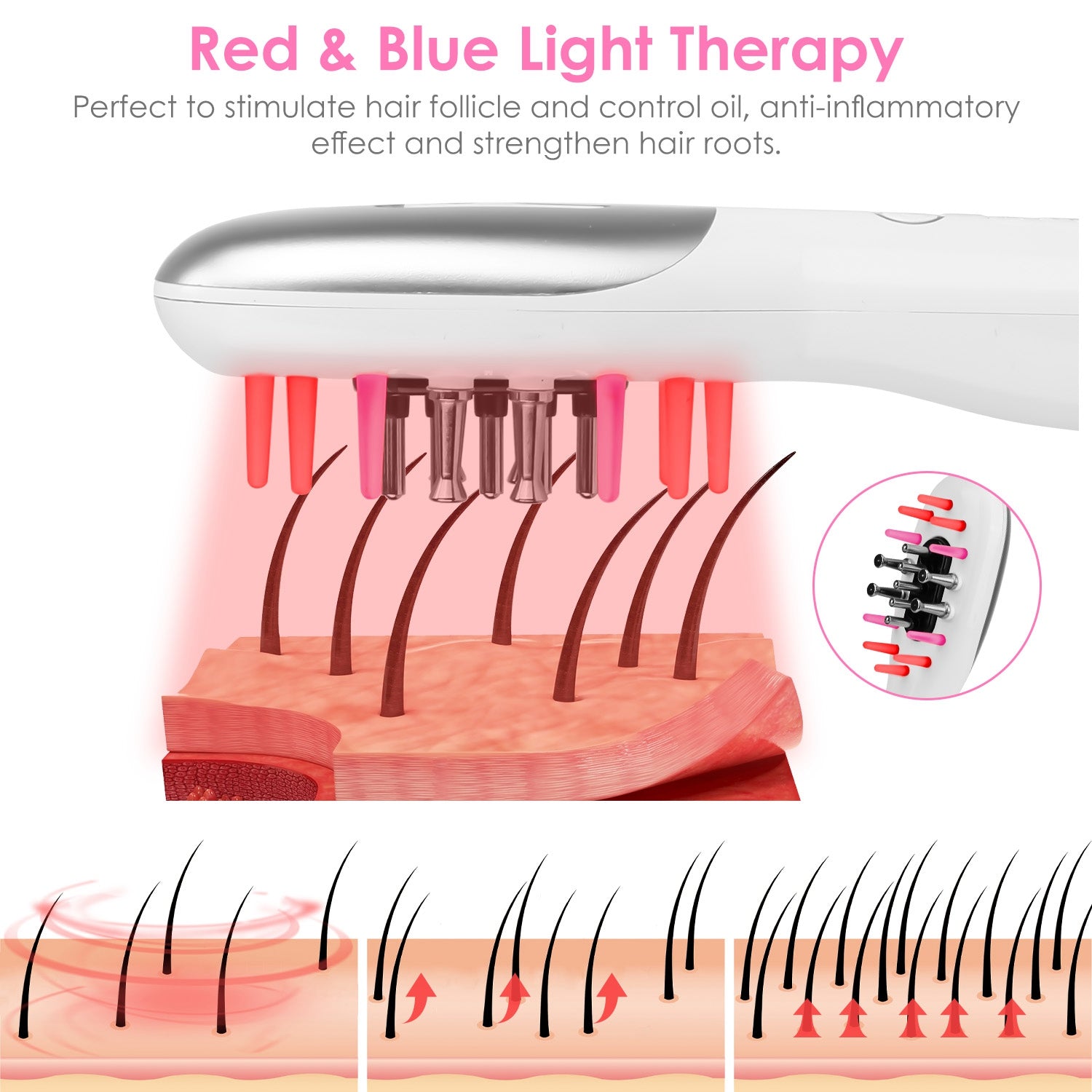 Red and blue light therapy